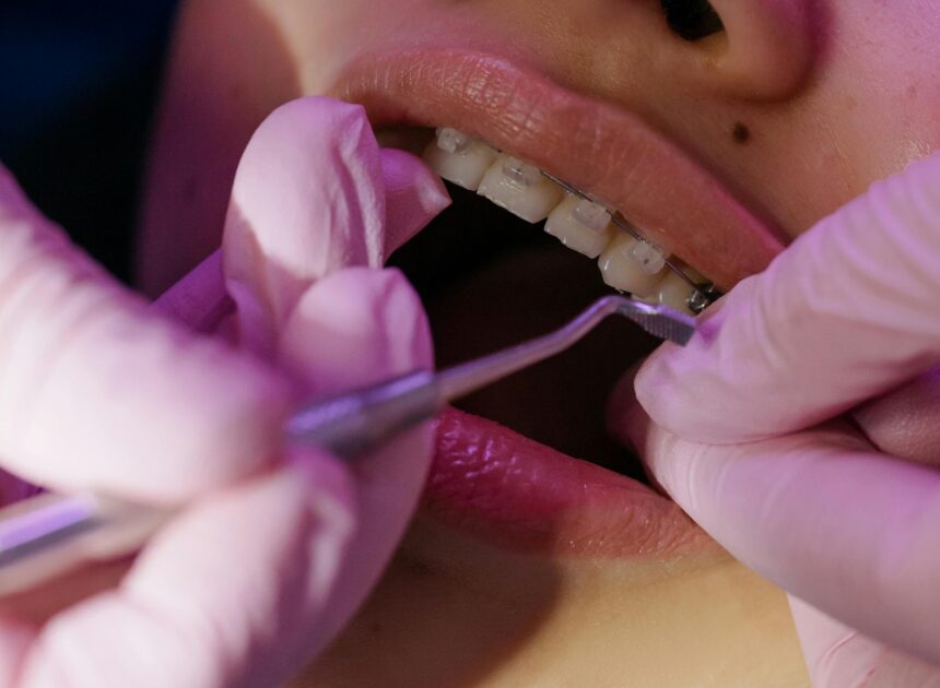 Orthodontist Enschede: specialist zorg voor een rechte en gezonde glimlach