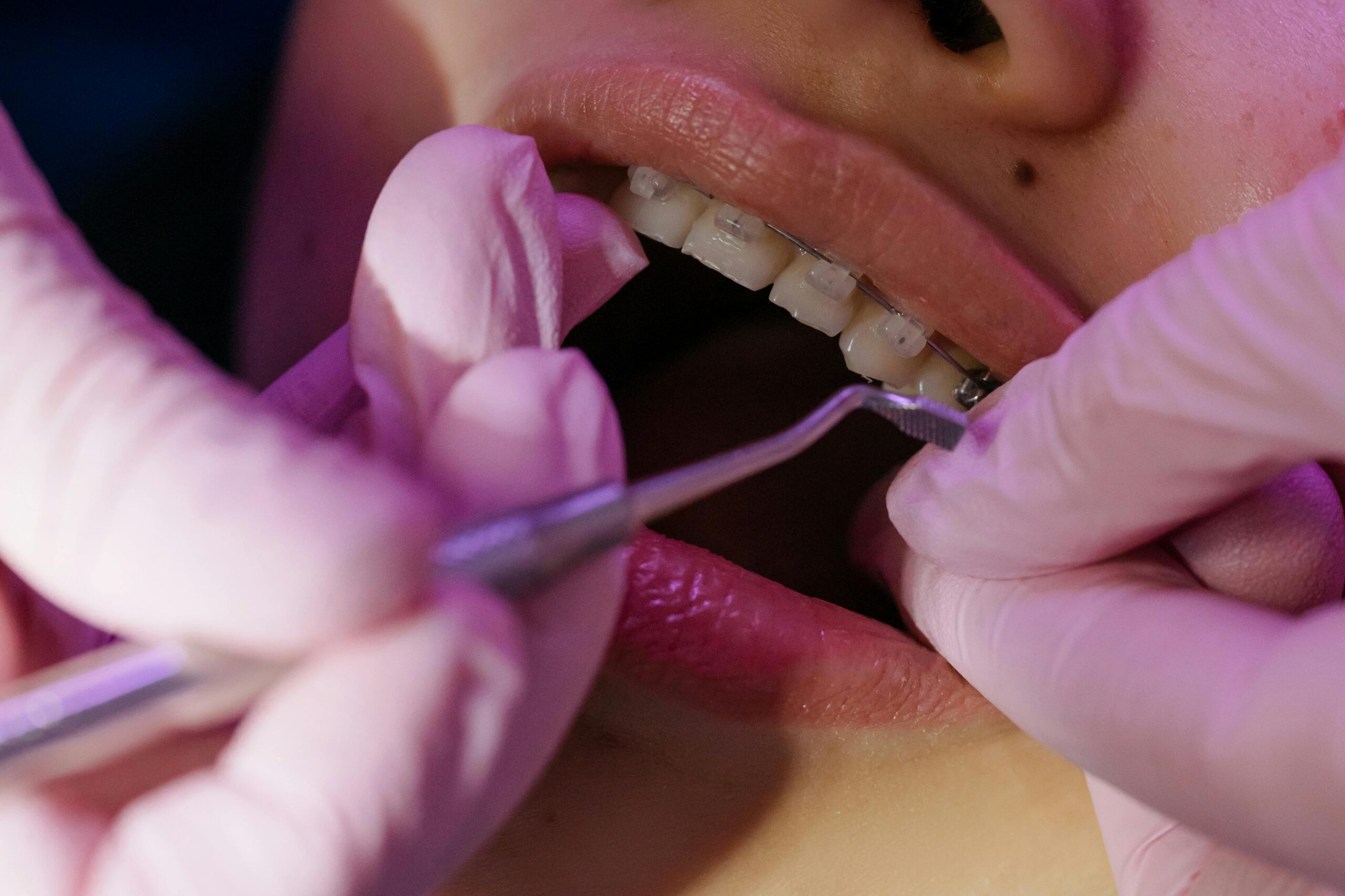 Orthodontist Enschede: specialist zorg voor een rechte en gezonde glimlach