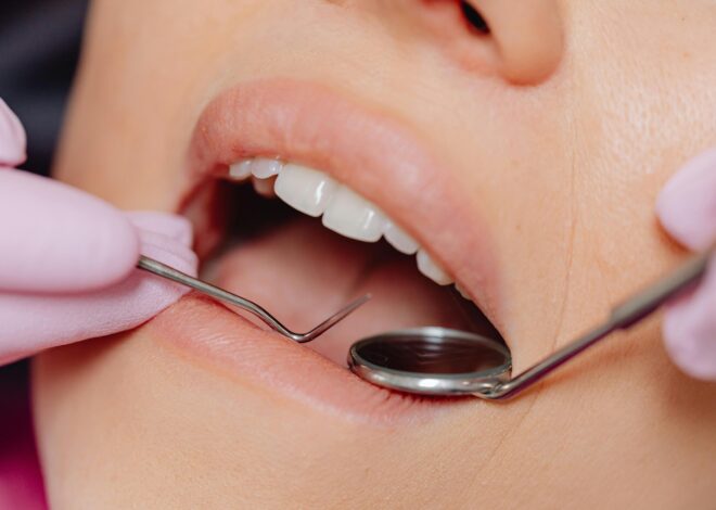 Mondhygiënist in Lochem: de basis voor een gezond gebit